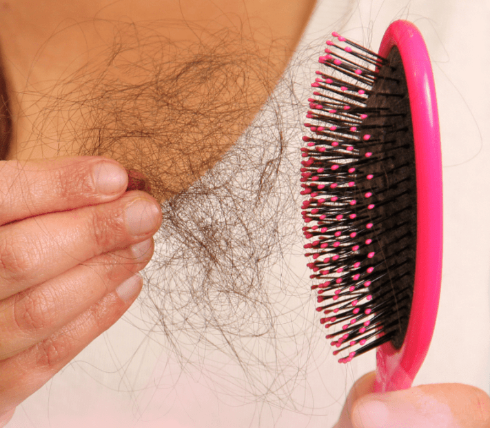 dermatologista explica tratamentos ara combater a queda de cabelo